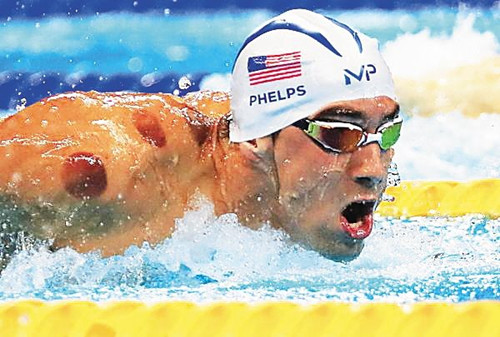 爆足球队医药箱有啥，堪比小型急救室但中国的队医配备各国都羡慕