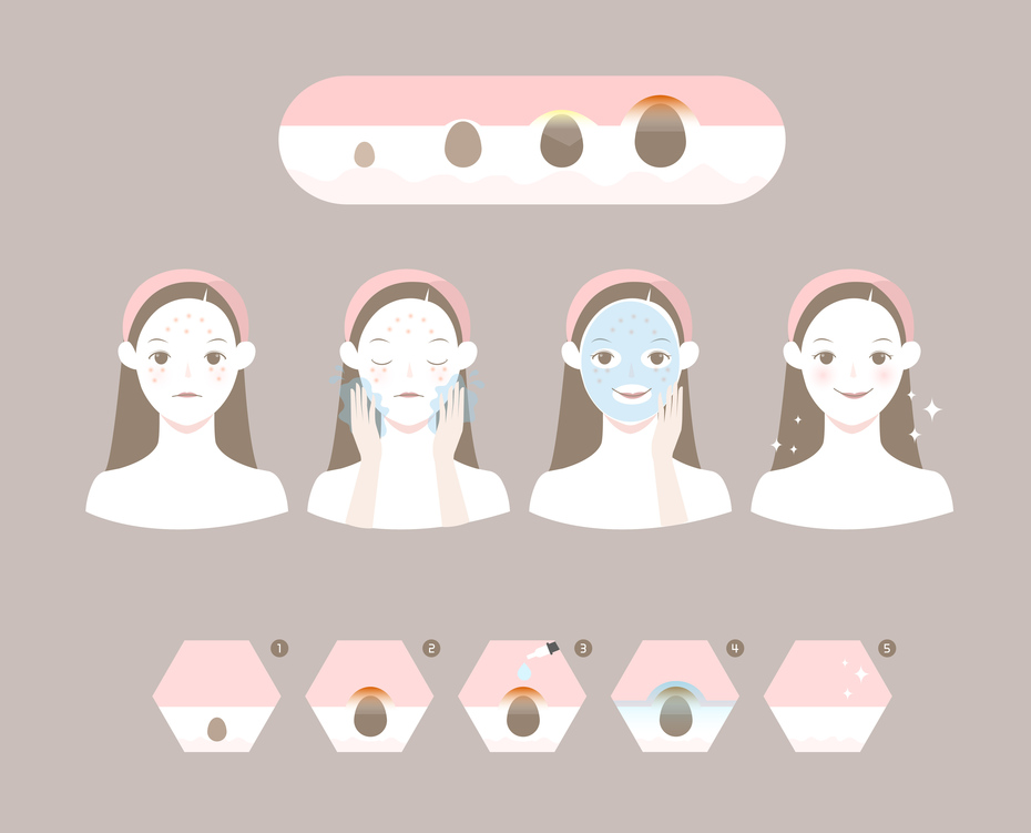 夏天身体长痘痘的原因和解决方法,夏天痘痘怎么调理