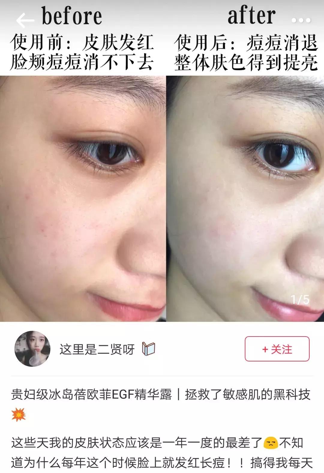 冰岛有什么值得买的礼物,冰岛有哪些值得购买的东西