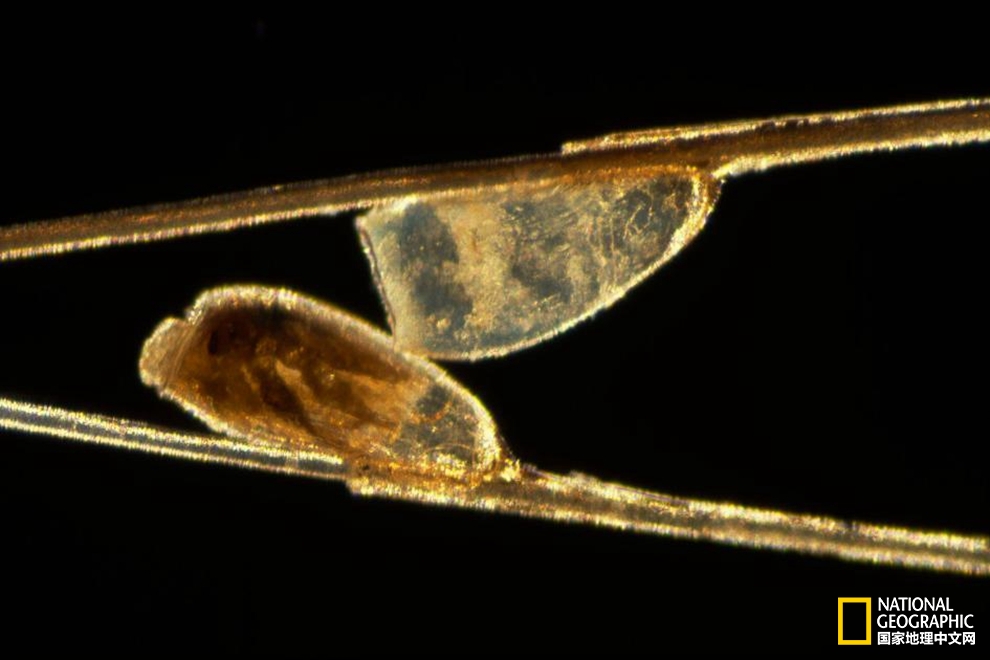 患者体内有寄生虫是什么感觉,体内有寄生虫身体会出现什么症状