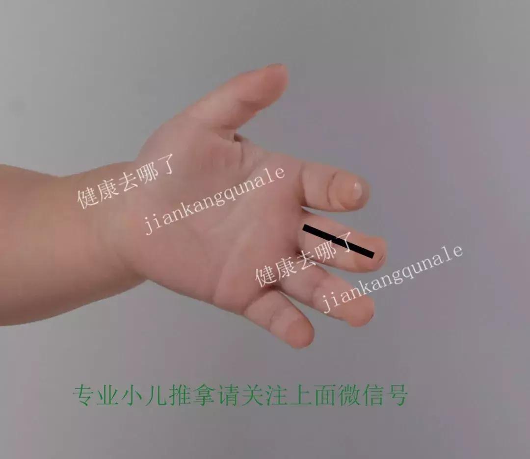 小儿睡觉易醒推拿哪些穴位,小儿睡眠障碍症怎么治疗