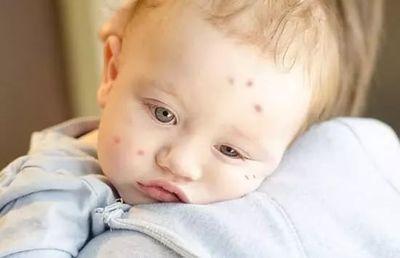 适合婴幼儿用的驱蚊液配方,3岁宝宝驱蚊液推荐