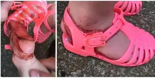 童鞋质量检测合格的品牌,童鞋鞋底磨损是质量问题吗