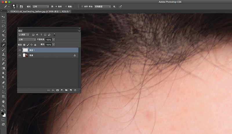 皮肤去痕修复神器,修复皮肤印痕方法