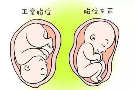 孕妇孕晚期怎么知道要生了,孕晚期临产胎儿没入盆能顺产吗