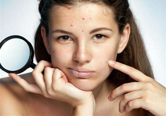 鼻子上黑头肆虐？4招深层清洁黑头，疏通毛孔