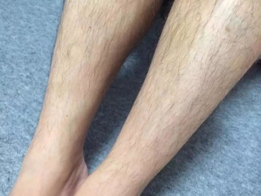 科普年龄大了人的体毛会变白吗,科普毛发的秘密