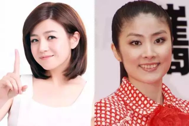 发际线太高显老这些神器了解一下,发际线不好看自己怎么弄