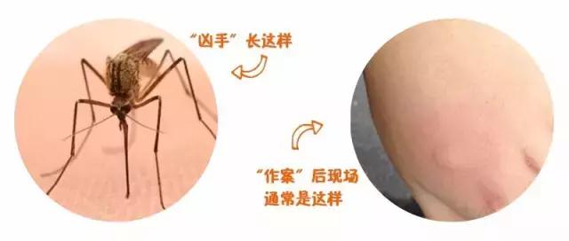宝宝被蚊虫叮咬最好的解决办法,宝宝被蚊虫叮咬后有什么好办法吗