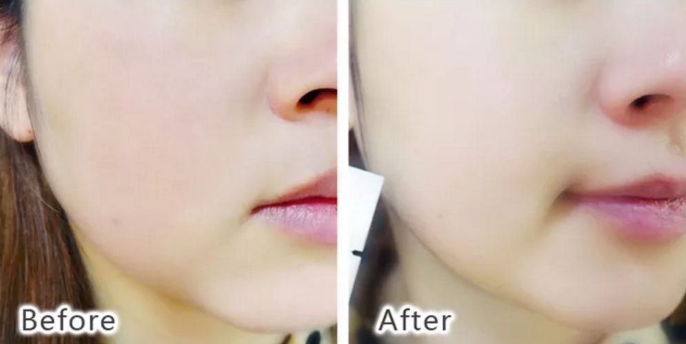 波兰美白面膜测评,德国抗老面膜推荐