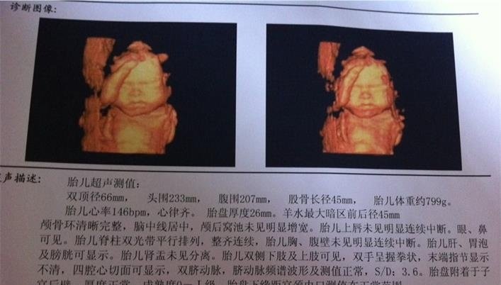 产检费用好贵啊,2019最完整详细的孕期产检价格