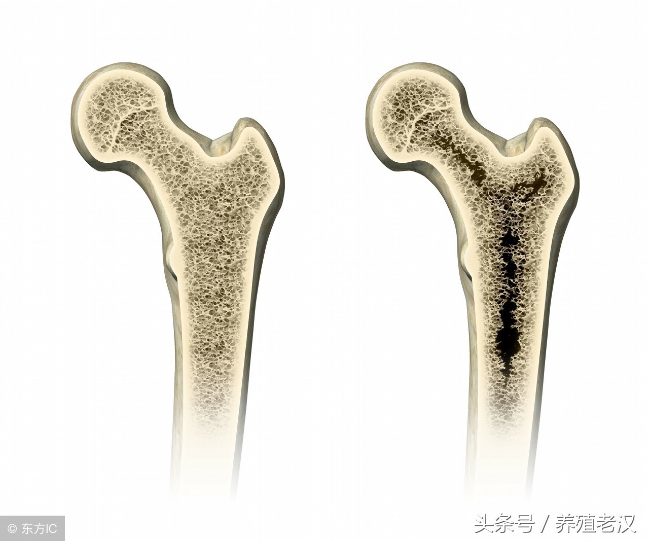 养殖户最怕的事：母猪产后瘫痪，病因和治疗方案都有了！