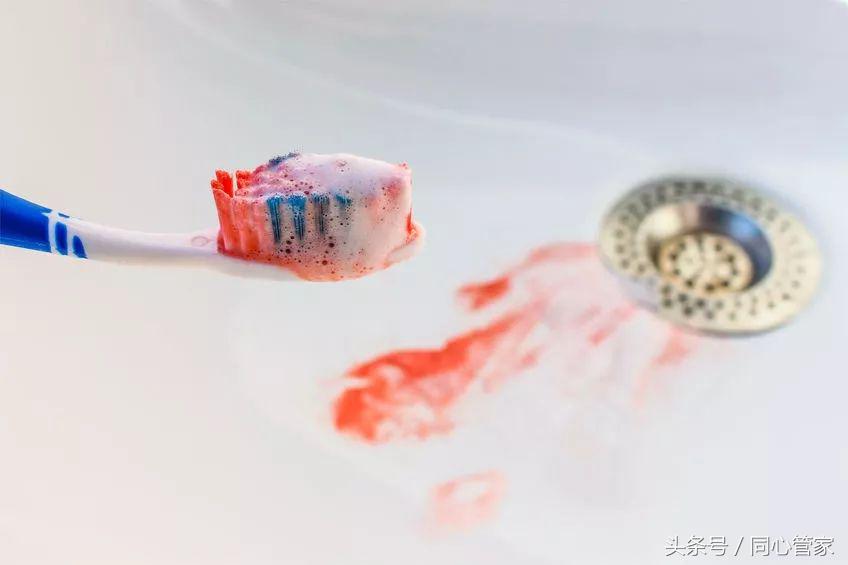 做血管支架手术后流鼻血怎么回事,淤青内出血要保持什么姿势