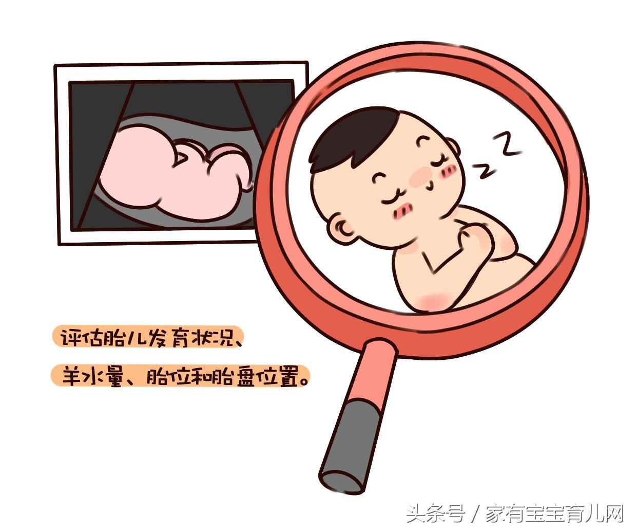 产检糖耐检查流程,最全的产检时间表和项目唐氏