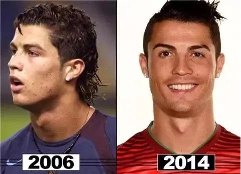 c罗整容过么,c罗整容了没