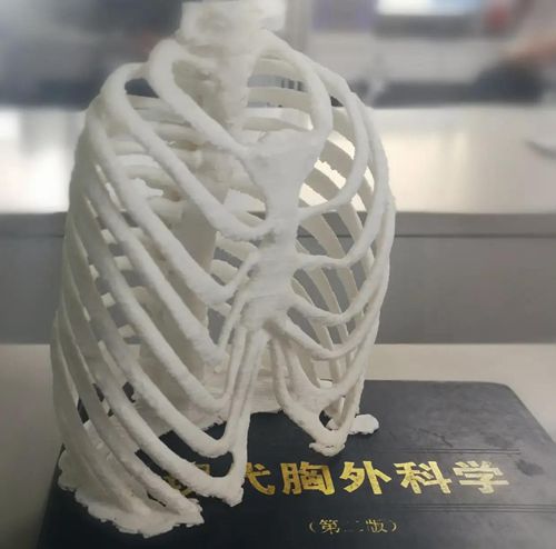 缺钙肋骨外翻怎么办还能补救吗,宝宝微量元素不缺钙但是肋骨外翻