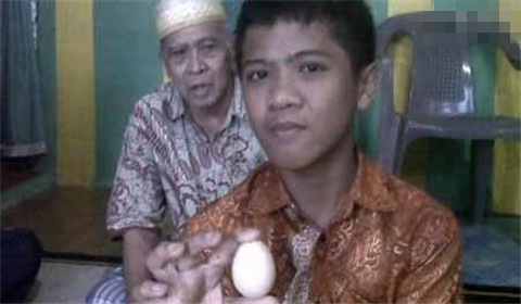 能下蛋的男人:印尼一男子竟每三月产蛋一次
