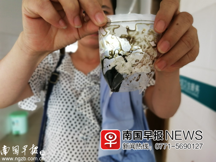 腿上缝针8天里面有好多脓,大腿缝长疙瘩流脓