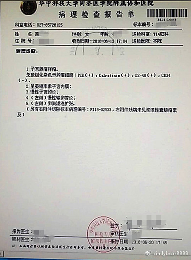 动画演示子宫全切术,动画演示切子宫手术
