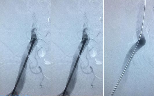 心血管内科急救流程,急诊静脉用药方法