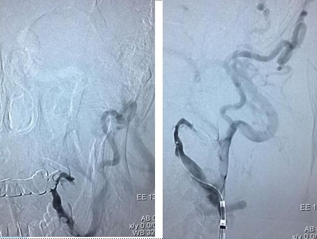 心血管内科急救流程,急诊静脉用药方法