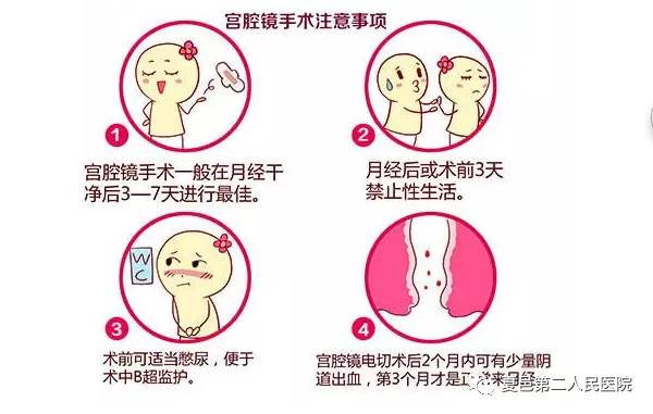 妇科微创内窥镜之宫腔镜——“洞若观火，斩妖除魔”