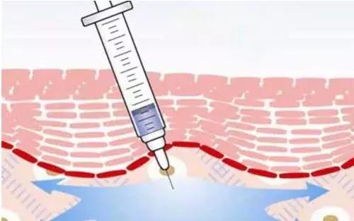 破伤风的严重后果,破伤风的正确处理方式