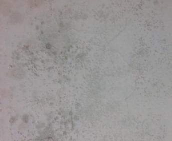 白墙脏用什么产品变白效果最好,白墙脏了怎么办的小妙招