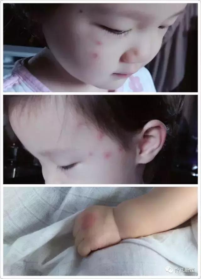 夏日防蚊必备三件套,好物推荐防蚊必备