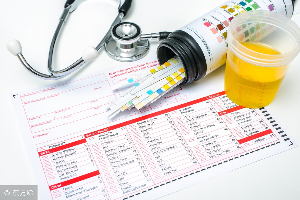 白带异常看什么科室,白带异常分析图