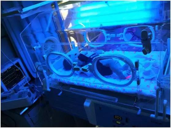 月子里的苦一辈子难忘,月子里的痛苦只有自己知道