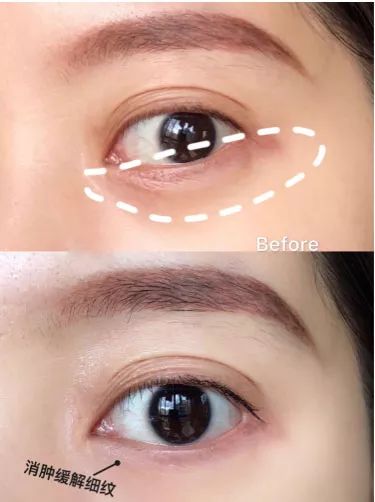 不可错过的超值产品系列,公认最好的三款眼霜