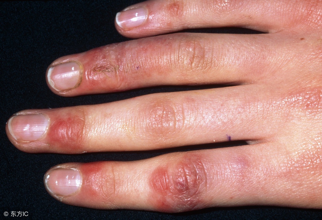 风油精孕妇可以用吗？它还有哪些不为人知的用途？