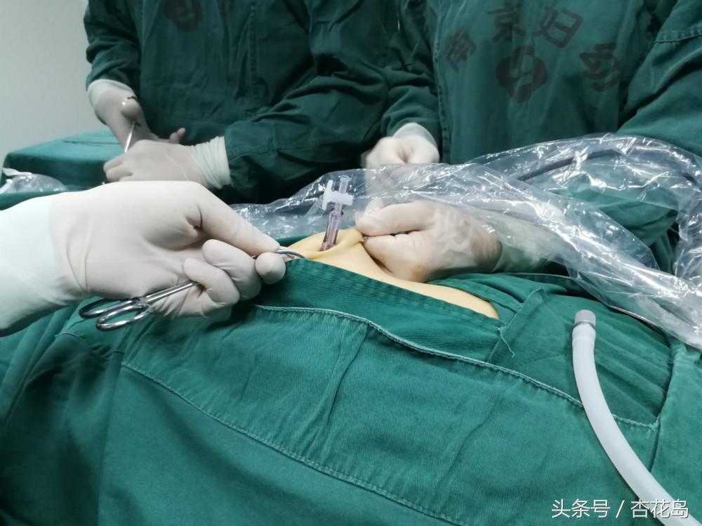 手术后引流管口流黄水,手术伤口流黄水带酸味