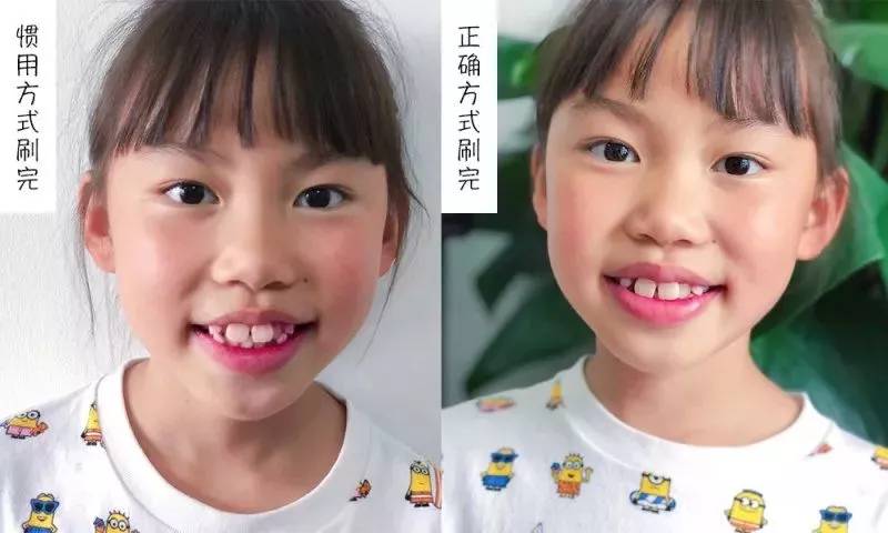 牙膏测评高露洁防蛀牙膏,牙膏推荐测评云南白药朗健