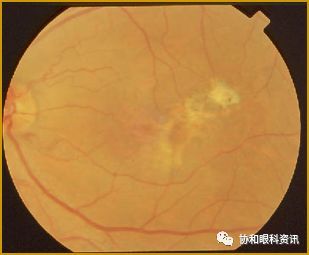 杏林失巨匠，后辈缅英灵——眼科各界深切缅怀张承芬教授