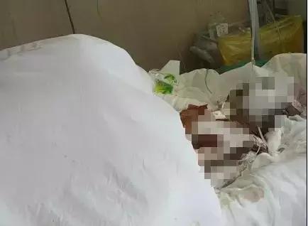 事发大连！不到俩月3人因它死亡！十多人严重受伤！