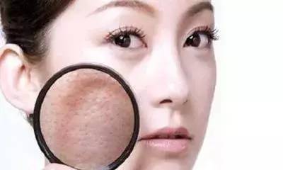 脸部螨虫怎么消灭才能彻底除根,脸上螨虫反复发作