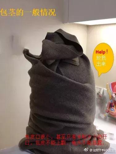 怎么判断自己的包皮需不需要割,如何判断包皮到底需不需要割