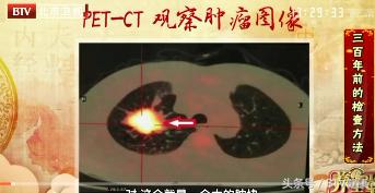 中医药大学教授治疗癌症,中国治疗癌症最权威的中医院