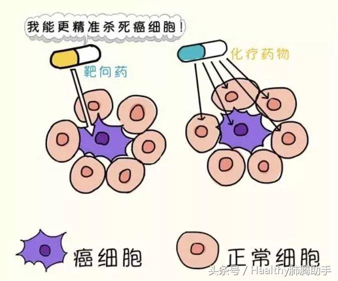 一文读懂靶向治疗,一文读懂医疗器械