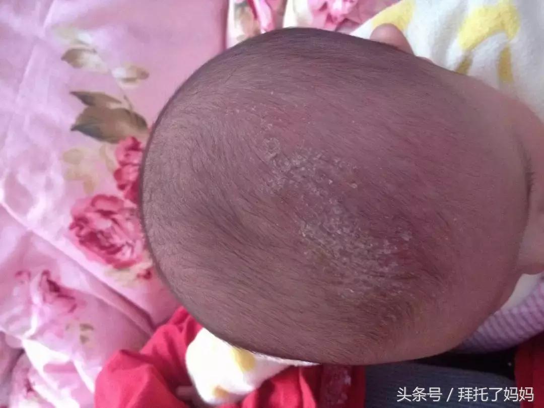 宝宝日常清洁的步骤,宝宝哪些地方不要太干净