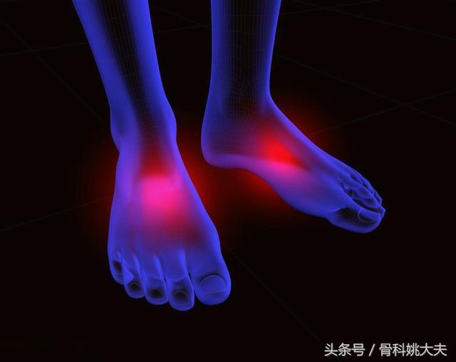 腰椎骨折以后应该怎么办？