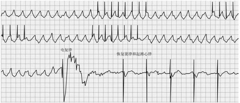 协和医院疑难杂症案例,协和医院疑难杂症视频