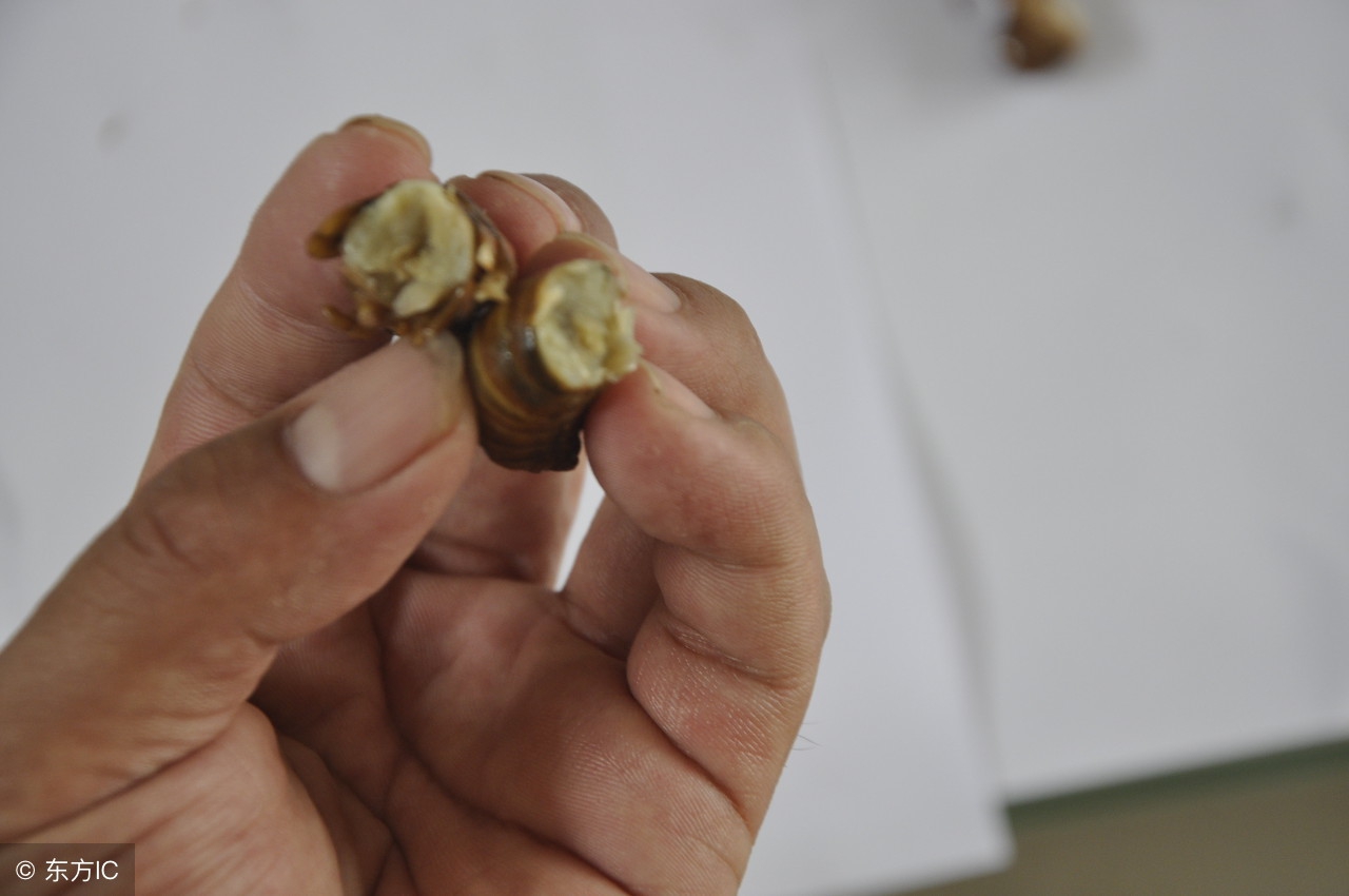 仔细检查你家孩子这个部位，你永远想不到孩子会把异物塞进这里！