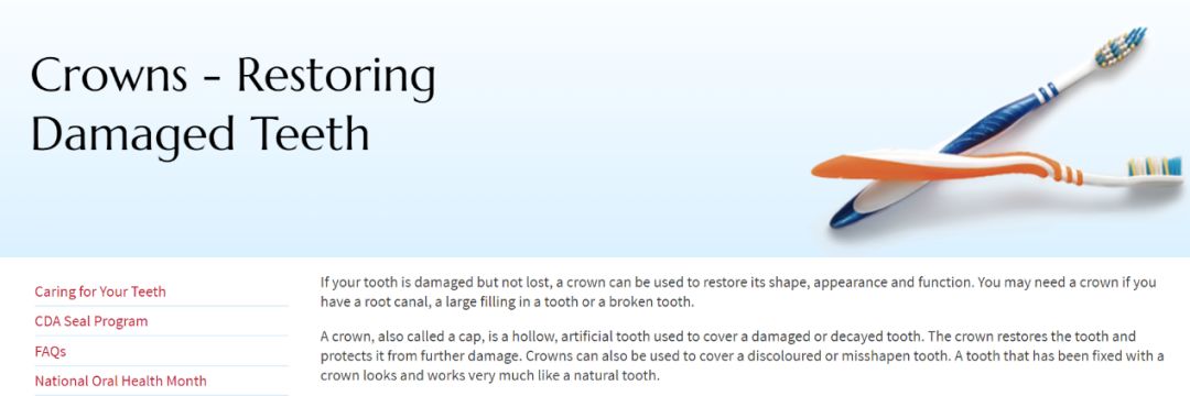 美容冠需要杀牙神经吗,美容冠是全瓷牙吗