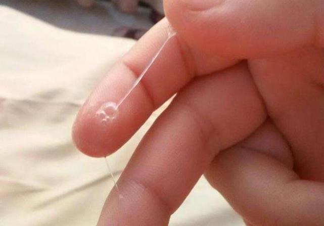 月经过后10几天又有出血怎么回事,排出鸡蛋清状液体表现已经排卵了