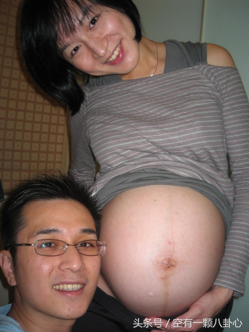 产前选项有什么重要性,产前好还是产后好