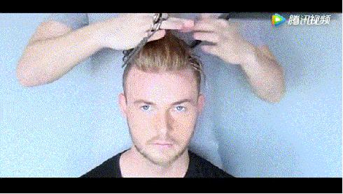 惨！90后集体脱发，发际线一去不复返！