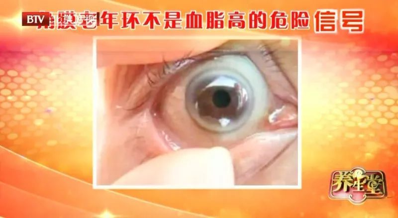 警惕血脂异常的3个信号,血脂异常的十大征兆